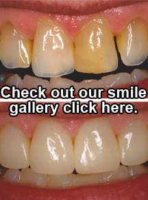 check out our smile gallery