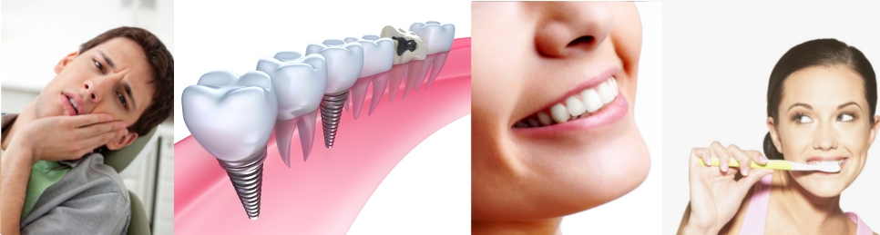 dental implants albert lea